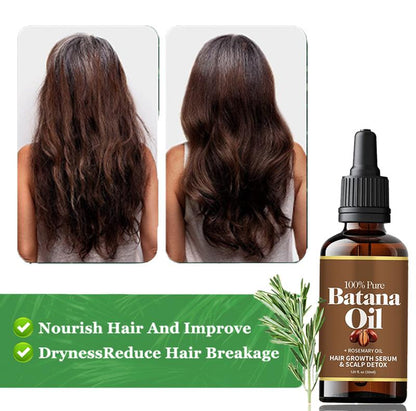 100% Pure Batana Oil with Rosemary Oil | Hair Growth & Scalp Nourishing Serum (30ml)
