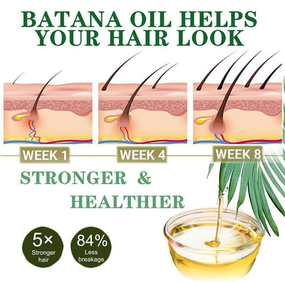 100% Pure Batana Oil with Rosemary Oil | Hair Growth & Scalp Nourishing Serum (30ml)